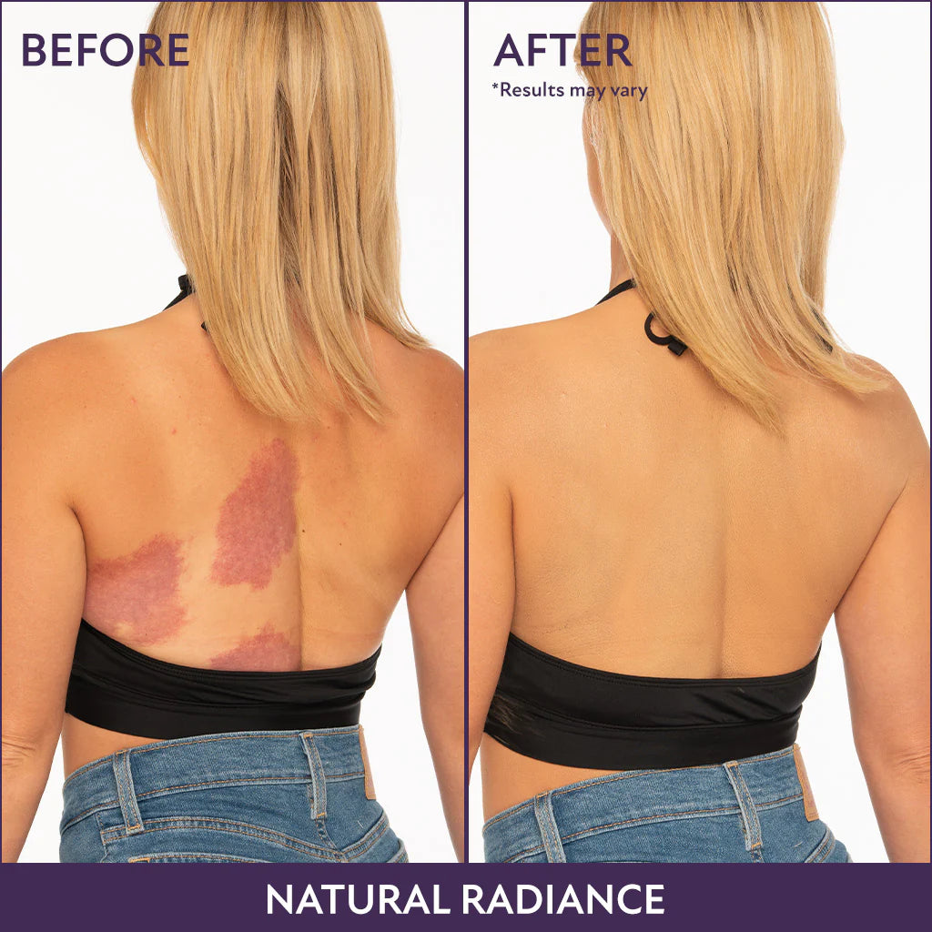 Westora™ Body Perfector