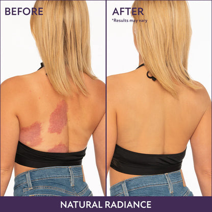 Westora™ Body Perfector